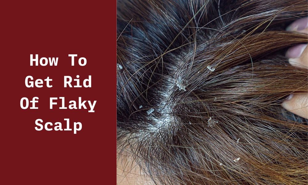 How_to_get_rid_of_flaky_scalp